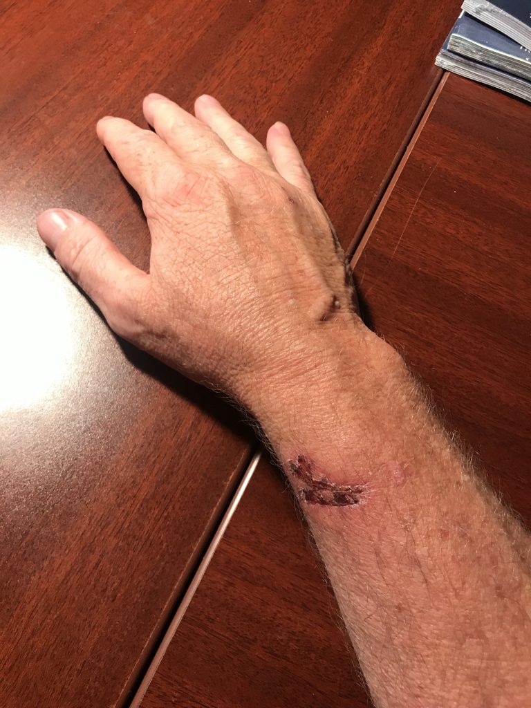 Keven Moore A pressure washer can be a useful tool, but users should