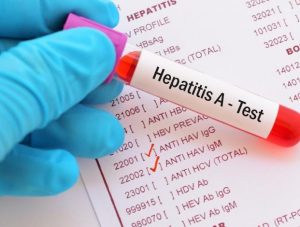 Hepatitis A outbreak in NKY declared over by Northern Kentucky Health Department