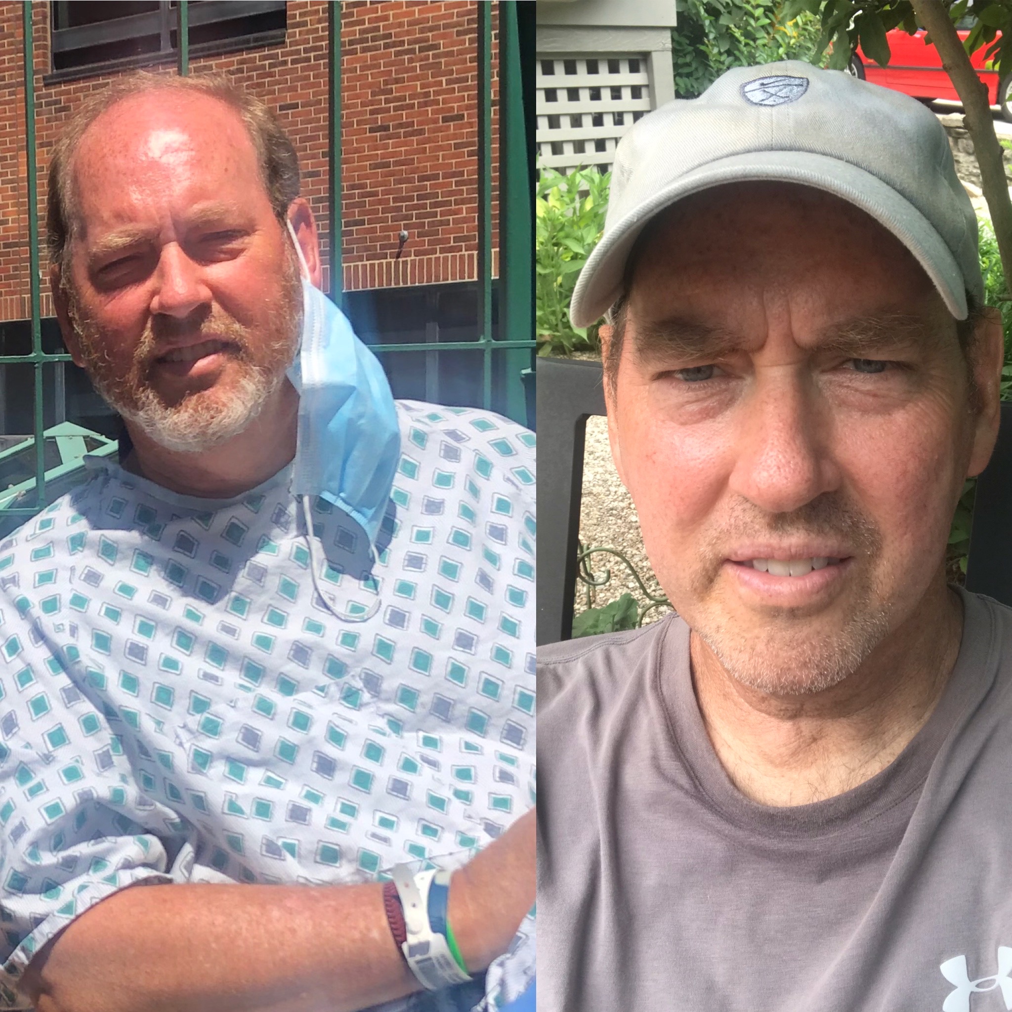 Tim Hanner, his own story: A second transplant, staying positive, embracing many lessons learned